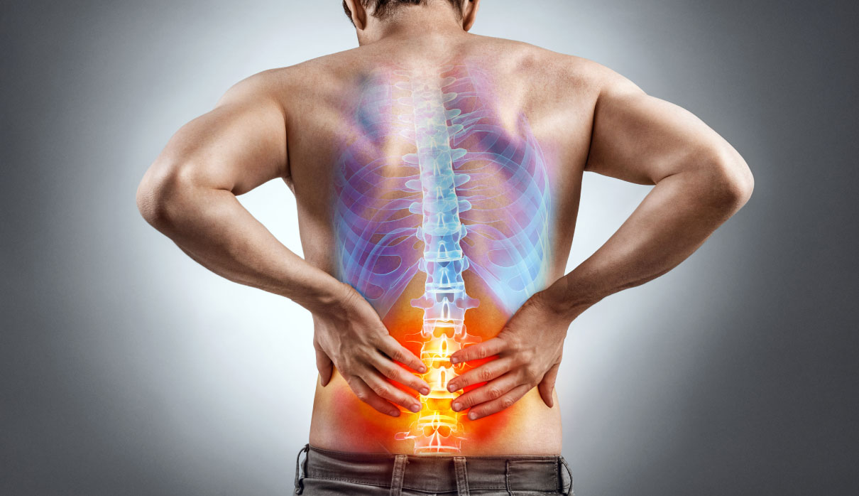 Herniated Disc Surgery